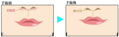 鼻 高く 熊本
