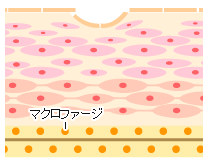 若返り 熊本