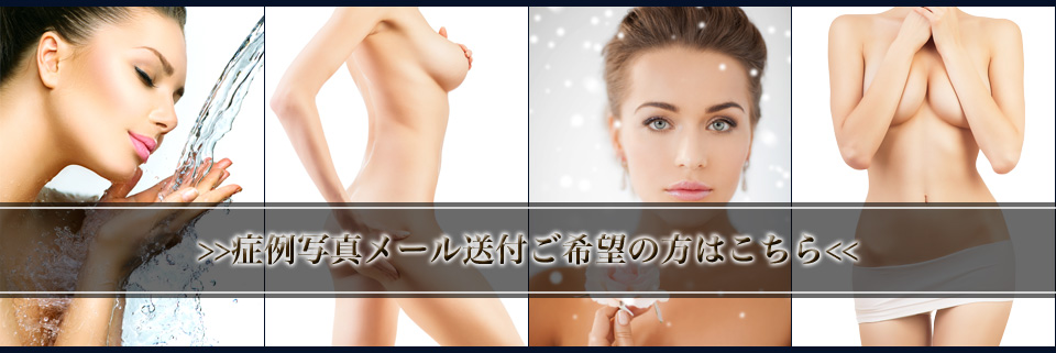 症例写真アクセスボタン