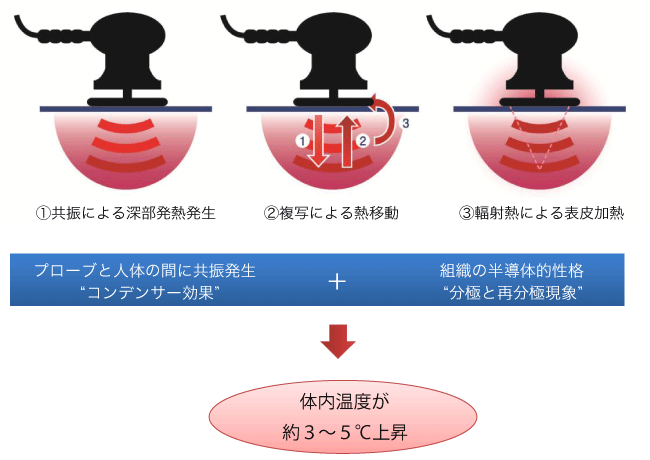 痩身 美容エステ部門 | 診療内容 | 熊本の美容外科・美容整形の