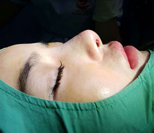 鼻の治療は熊本の美容外科ハニークリニックへ
