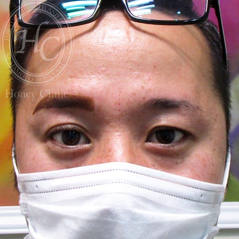 アートメイクをするなら熊本の美容外科ハニークリニックへ