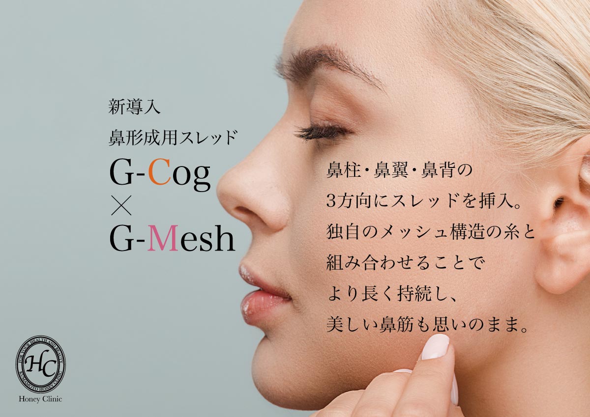 鼻形成用スレッド　G-Cog・G-Mesh(Gコグ・Gメッシュ)　鼻柱・鼻翼・鼻背の3方向にスレッドを挿入。独自のメッシュ構造の糸と組み合わせることでより長く持続し、美しい鼻筋も思いのまま。