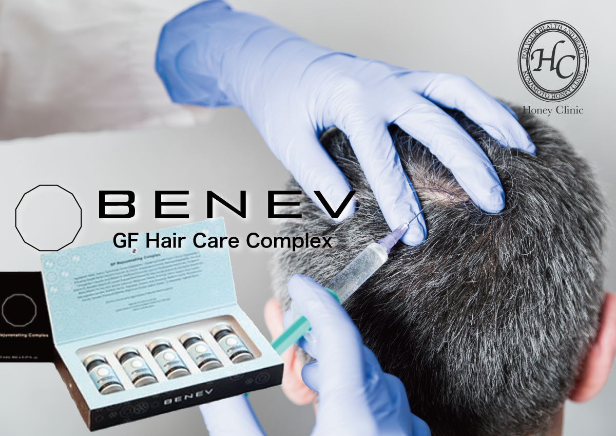 BENEV療法は、数種類の成長因子を配合した薬剤（GF Hair Care Complex）を頭皮に注入する毛髪再生療法です。