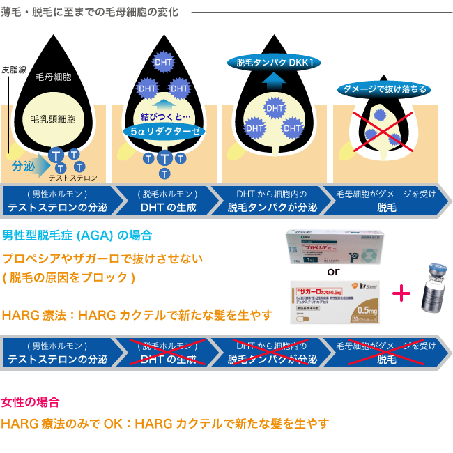 HARG(ハーグ)療法で成長期を長くし、休止期を短くします