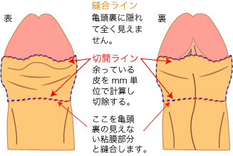 男性器 陰茎 - Wikipedia