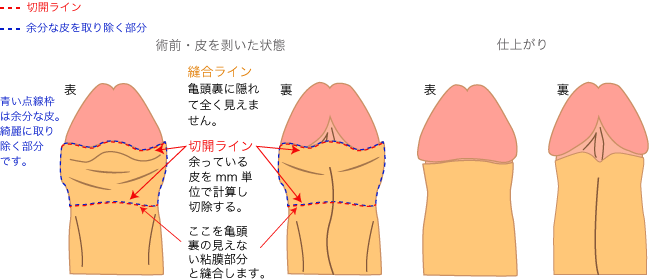 ほうけい 手術 熊本