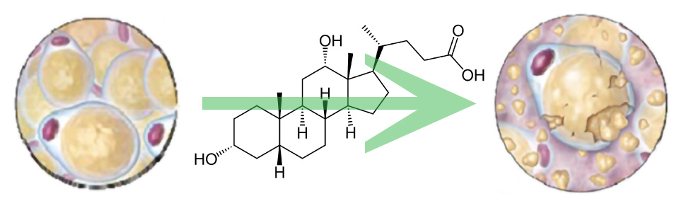 デオキシコール酸イメージ