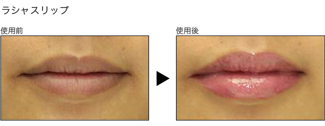 ラシャスリップス 熊本