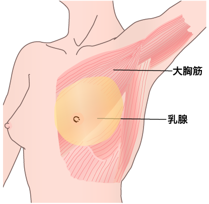 豊胸 熊本