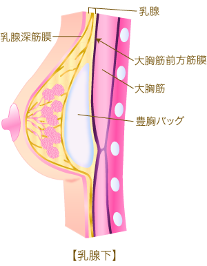 豊胸術 熊本