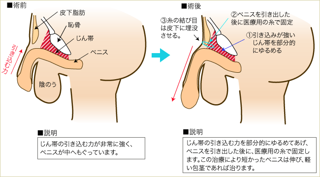 男性器 男性器”ってペニスのことですか？ 【専門医が回答！男性の体 ...