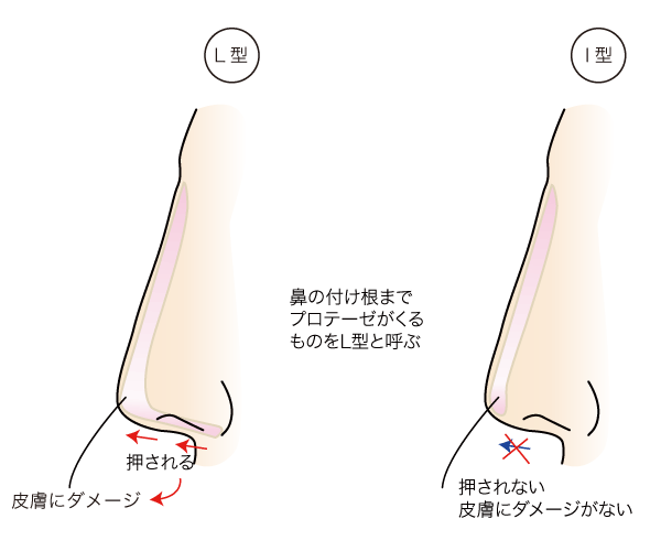 鼻の整形を行うなら熊本の美容外科ハニークリニックへ