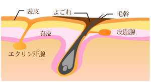 毛穴の開き 黒ずみ にきび にきび跡 くすみ 肝斑 熊本