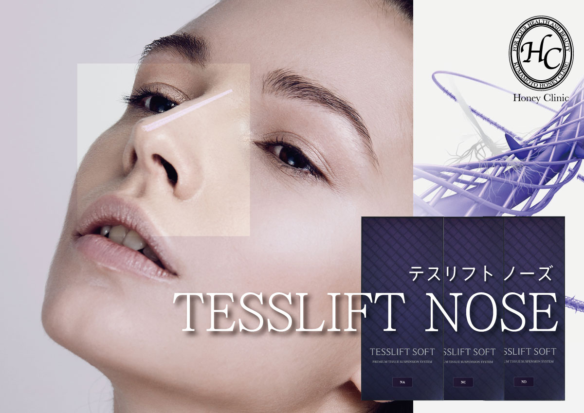 鼻鼻形成専用スレッド　TESSLIST　NOSE(テスリフトノーズ)