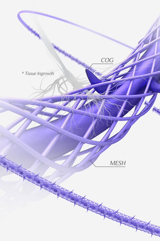 最大限の効果を引き出す、360°方向のバーブと、3Dメッシュの独自の構造。