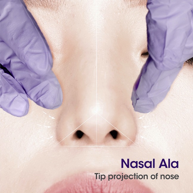 TESSLIFT SOFT NOSE NA