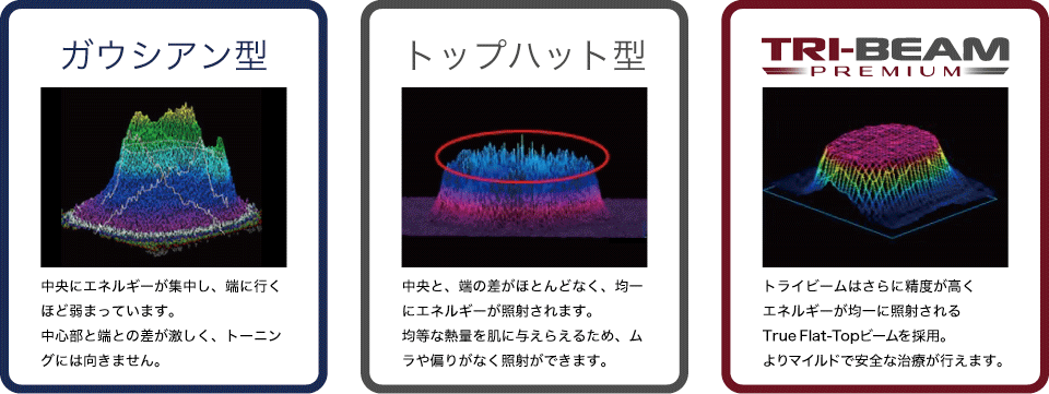 ガウシアン型・トップハット型レーザーについての解説画像