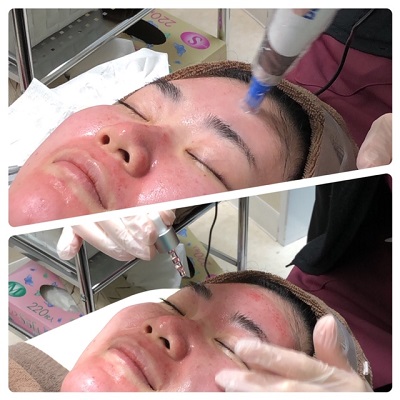 インフォメーション ハニークリニック 熊本の美容外科 エイジングケア アートメイク 脱毛 薄毛治療は ハニークリニック
