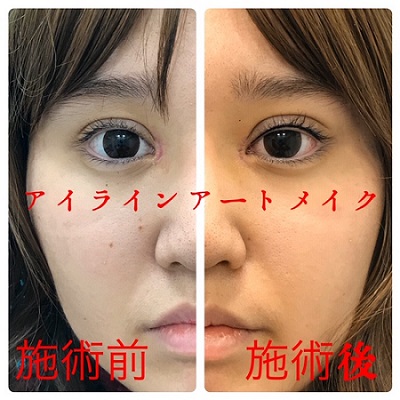 インフォメーション ハニークリニック 熊本の美容外科 エイジングケア アートメイク 脱毛 薄毛治療は ハニークリニック