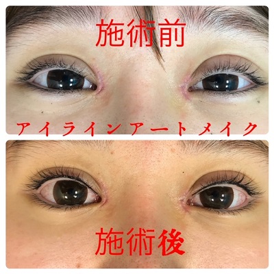 インフォメーション ハニークリニック 熊本の美容外科 エイジングケア アートメイク 脱毛 薄毛治療は ハニークリニック
